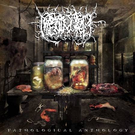 Hipermenorrea : Pathological Anthology